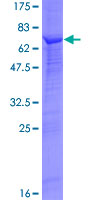 SDS-PAGE - Recombinant Human SKP2 protein (AB114385)