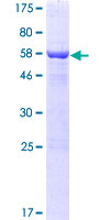 Recombinant Human SLAIN2 protein