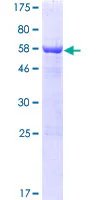 SDS-PAGE - Recombinant Human SLAIN2 protein (GST tag N-Terminus) (AB163604)