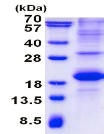 SDS-PAGE - Recombinant Human SLAM / CD150 protein (denatured) (His tag N-Terminus) (AB139259)