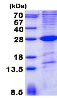SDS-PAGE - Recombinant Human SLAMF6 protein (denatured) (His tag N-Terminus) (AB137148)