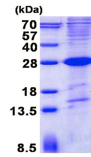 SDS-PAGE - Recombinant Human SLAMF6 protein (denatured) (His tag N-Terminus) (AB137148)