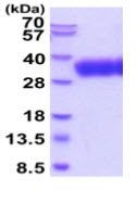 SDS-PAGE - Recombinant Human SLAMF6 protein (His tag C-Terminus) (AB219428)