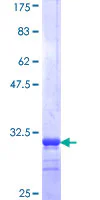 SDS-PAGE - Recombinant Human SLC13A5 protein (GST tag N-Terminus) (AB166162)