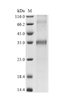 SDS-PAGE - Recombinant Human SLC14A1 Protein (His Tag) (AB314628)