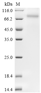 SDS-PAGE - Recombinant human SLC23A2 protein (His tag) (AB314520), expandable thumbnail