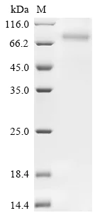 SDS-PAGE - Recombinant human SLC23A2 protein (His tag) (AB314520)