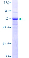 SDS-PAGE - Recombinant Human SLC25A11 protein (GST tag N-Terminus) (AB152862)