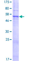 SDS-PAGE - Recombinant Human SLC25A38 protein (AB162922)