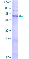SDS-PAGE - Recombinant Human SLC25A38 protein (AB162922)