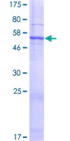 SDS-PAGE - Recombinant Human SLC25A38 protein (GST tag N-Terminus) (AB162922)