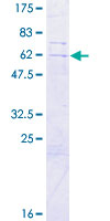 Recombinant Human SLC25A43 protein