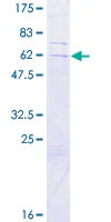 SDS-PAGE - Recombinant Human SLC25A43 protein (GST tag N-Terminus) (AB165903)