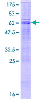 SDS-PAGE - Recombinant Human SLC26A5 protein (AB166381)