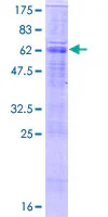 SDS-PAGE - Recombinant Human SLC26A5 protein (GST tag N-Terminus) (AB166381)