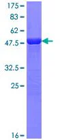 SDS-PAGE - Recombinant Human SLC27A4 / FATP4 protein (GST tag N-Terminus) (AB132824)