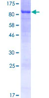 SDS-PAGE - Recombinant Human SLC27A5/BAL protein (GST tag N-Terminus) (AB161232)