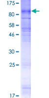SDS-PAGE - Recombinant Human SLC28A2 protein (GST tag N-Terminus) (AB160363)