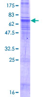 SDS-PAGE - Recombinant Human SLC35B2 protein (AB166331)