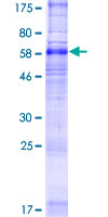 SDS-PAGE - Recombinant Human SLC35F2 protein (AB162823)