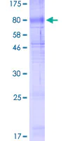 SDS-PAGE - Recombinant Human SLC40A1 protein (AB153316)