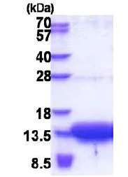 SDS-PAGE - Recombinant Human SLC51B protein (His tag N-Terminus) (AB171468)