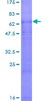 SDS-PAGE - Recombinant Human SLC7A9 protein (AB161312)