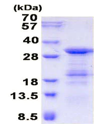 SDS-PAGE - Recombinant Human SLD5 protein (AB136703)