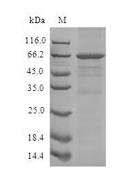 SDS-PAGE - Recombinant Human SLFN12L Protein (His Tag) (AB314624)