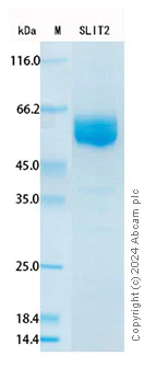 SDS-PAGE - Recombinant Human Slit2 Protein Standard (His tag) (AB316436)