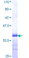 Recombinant Human Slit3 protein
