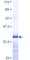 SDS-PAGE - Recombinant Human Slit3 protein (GST tag N-Terminus) (AB116753)