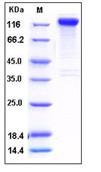 SDS-PAGE - Recombinant Human Slitrk1 protein (Fc Chimera His Tag) (AB276254)