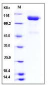 SDS-PAGE - Recombinant Human SLITRK4 protein (His tag) (AB276503)