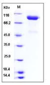 SDS-PAGE - Recombinant Human SLITRK4 protein (His tag) (AB276503)