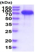 SDS-PAGE - Recombinant Human SLP76 protein (His tag) (AB227404)