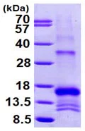 SDS-PAGE - Recombinant Human SLPI protein (His tag N-Terminus) (AB99142)