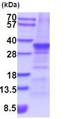 SDS-PAGE - Recombinant Human SLUG protein (AB201878), expandable thumbnail