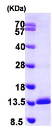 Western blot - Recombinant Human Sm-E protein (AB104036)