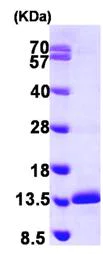 Western blot - Recombinant Human Sm-E protein (His tag N-Terminus) (AB104036)
