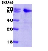 SDS-PAGE - Recombinant Human Smad2 protein (AB85329)
