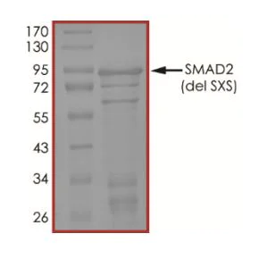 SDS-PAGE - Recombinant Human Smad2 protein (deletion aa465-467)(Tagged) (AB268973)