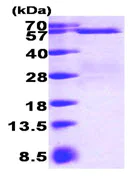 SDS-PAGE - Recombinant Human Smad3 protein (His tag N-Terminus) (AB89353)