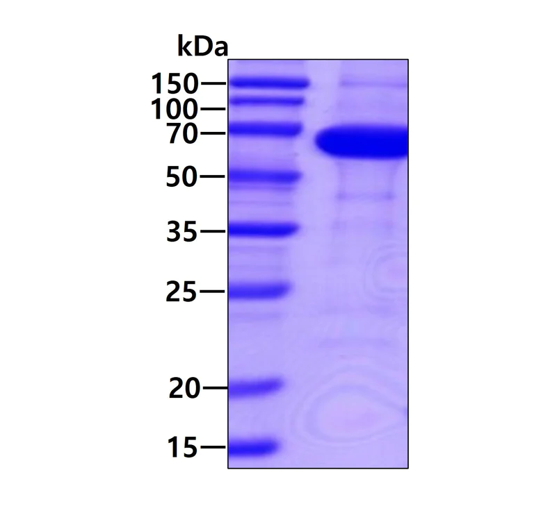 SDS-PAGE - Recombinant Human Smad4 protein (AB81764)