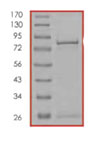 Recombinant Human SMAD5 protein