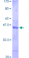 SDS-PAGE - Recombinant Human SMAD6 protein (AB158843)