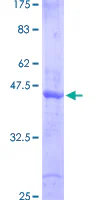SDS-PAGE - Recombinant Human SMAD6 protein (GST tag N-Terminus) (AB158843)