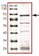 SDS-PAGE - Recombinant Human SMAD9 protein (AB140808)