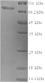SDS-PAGE - Recombinant Human SMARCA2 / BRM protein (Tagged) (AB236192), expandable thumbnail