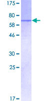 SDS-PAGE - Recombinant Human SMARCA6 protein (GST tag N-Terminus) (AB114875)